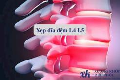Xẹp đĩa đệm L4 L5 là gì? Tìm hiểu triệu chứng, nguyên nhân và cách điều trị
